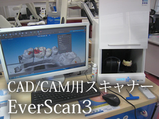 CAD/CAM用スキャナー EverScan3