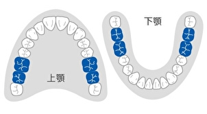 大臼歯CAD/CAM冠の算定条件