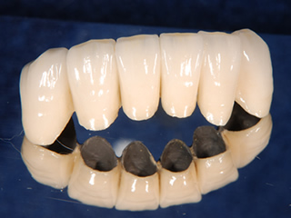 歯科技工/ハラボンド2×8.4g/メタルボンド/金属/メタル/サンプル