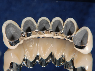 歯科技工/ハラボンド2×8.4g/メタルボンド/金属/メタル/サンプル